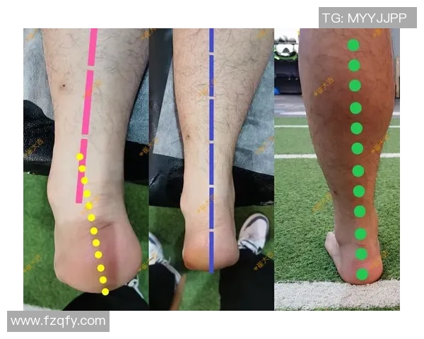 世界足球巨星O型腿最严重案例解析及其影响力深度分析